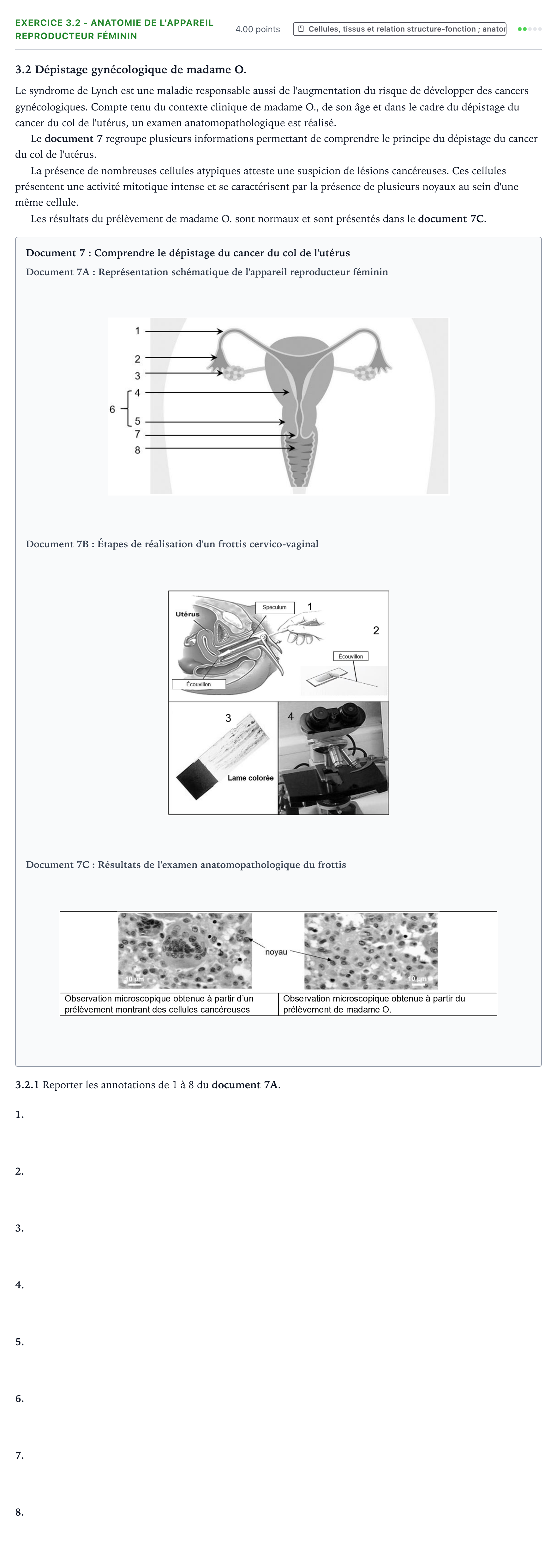 Énoncé: Exercice 3.2 - Anatomie de l'appareil reproducteur féminin · Bac ST2S Chimie, Biologie et Physiopathologie Humaines Métropole remplacement 2024